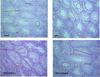 Omega-3 fatty acid ameliorates bisphenol F-induced testicular toxicity by modulating Nrf2/NFkB pathway and apoptotic signaling